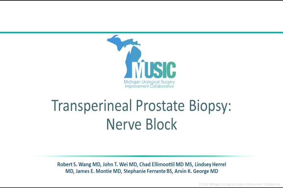 Prostate biopsy